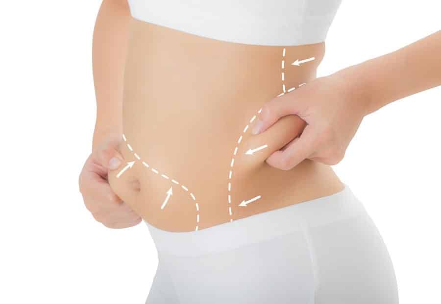 Tummy Tuck in Turkey