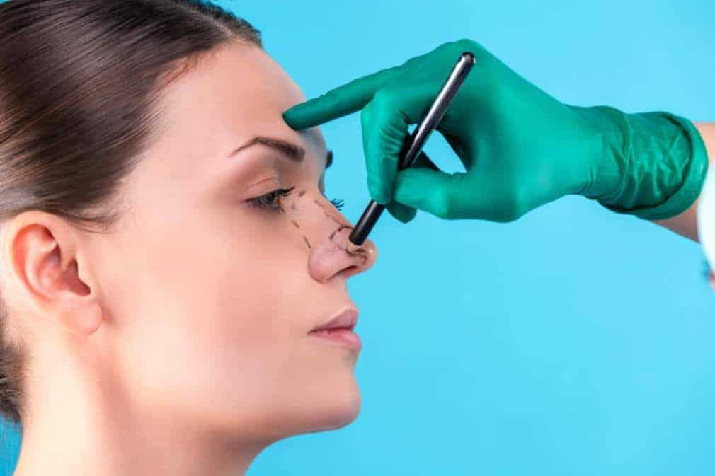Rhinoplasty Istanbul