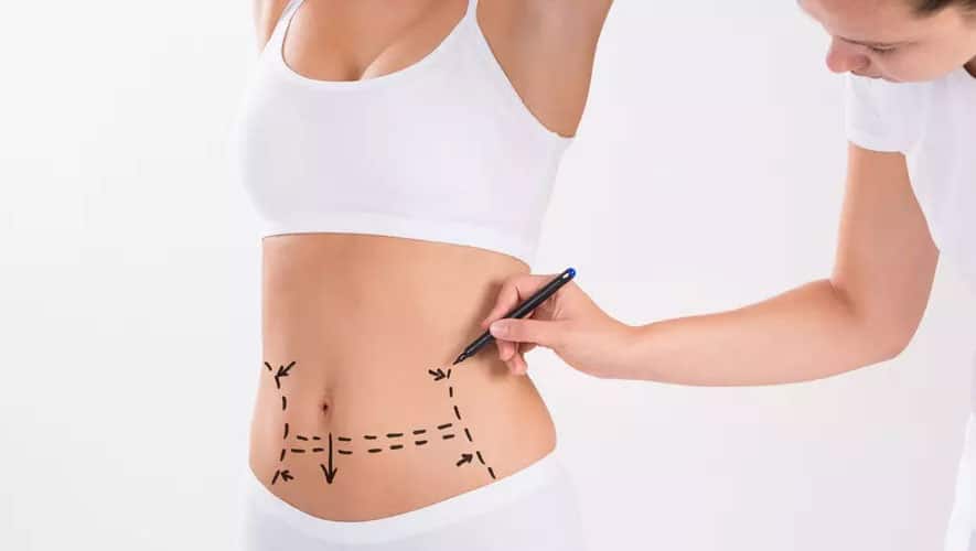 abdominoplasty turkey