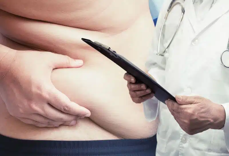 bariatric surgery