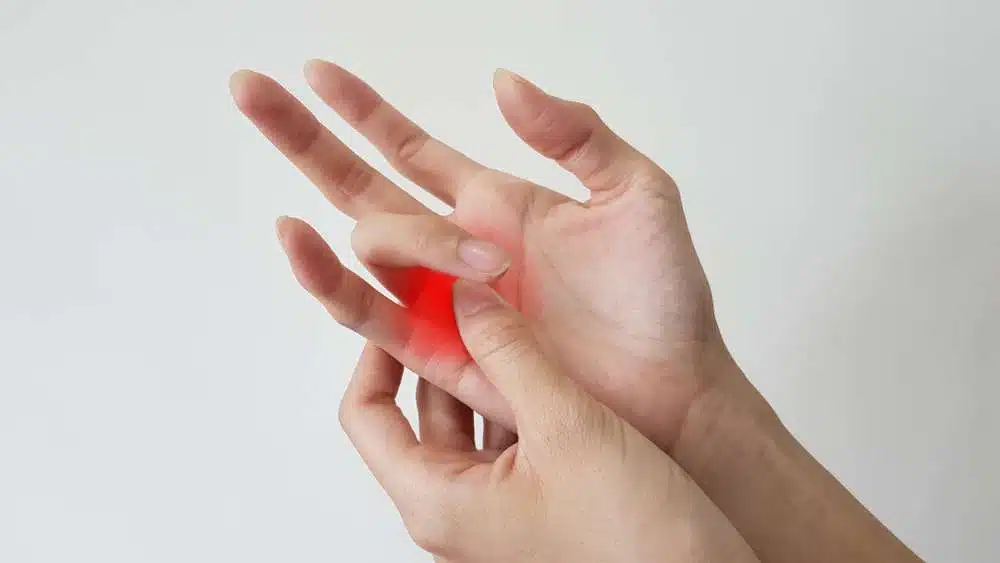 trigger finger release surgery​ in turkey