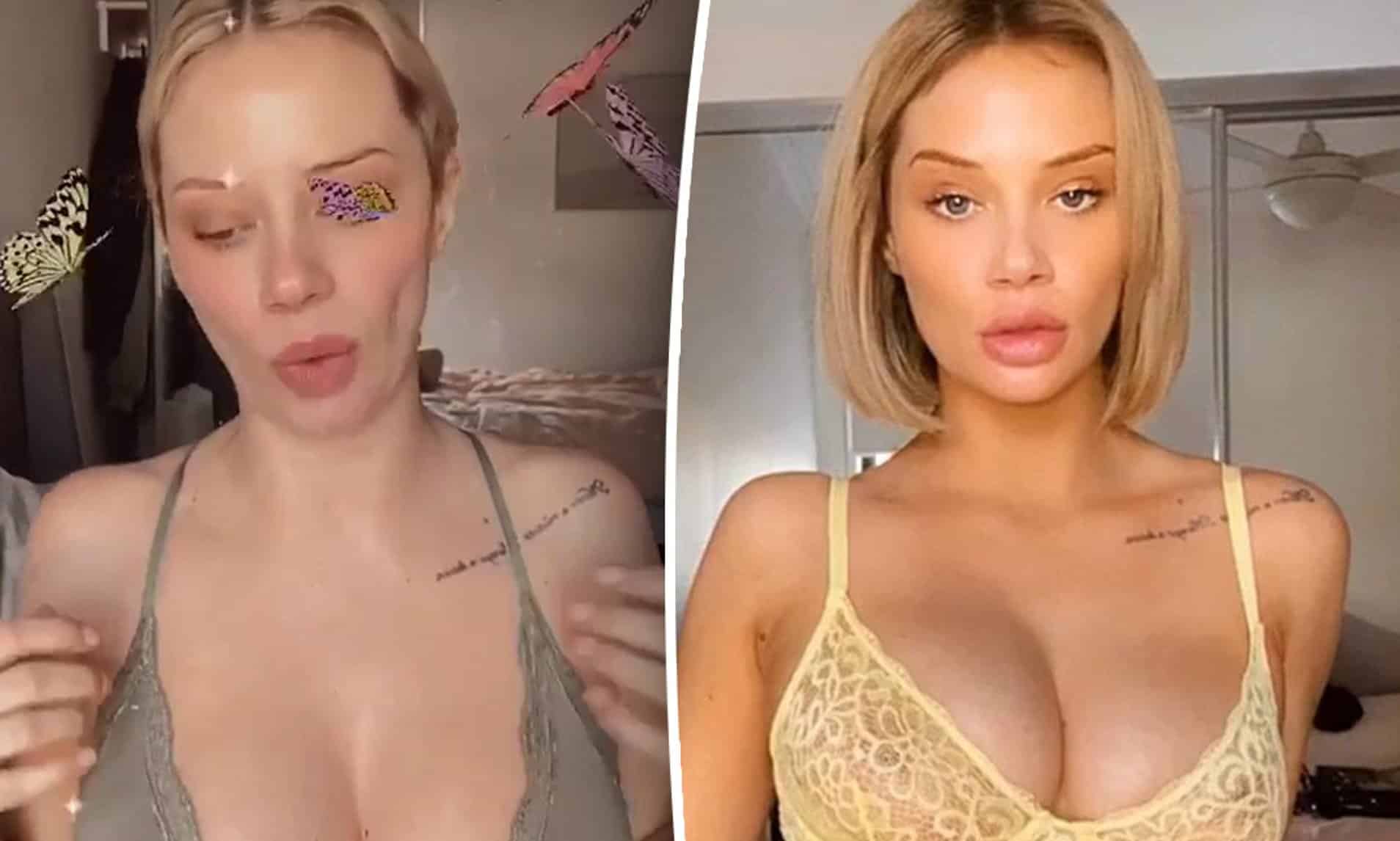 boob job turkey