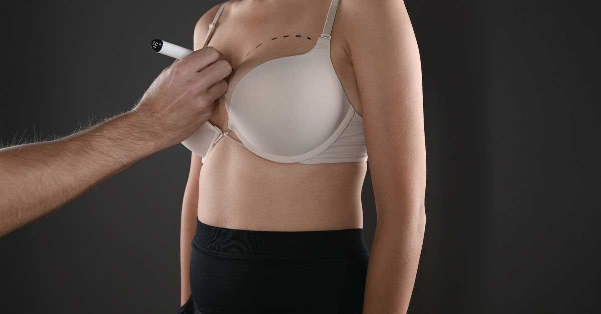breast augmentation istanbul