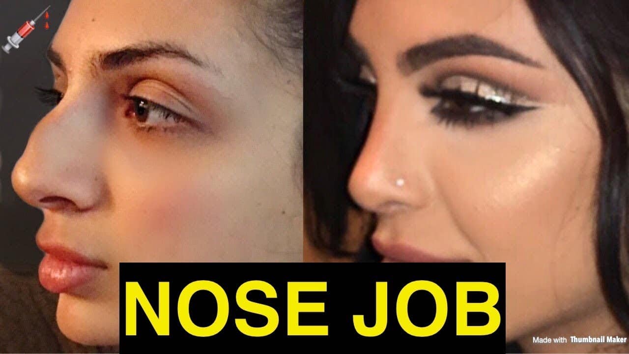 how much does a nose job cost with insurance