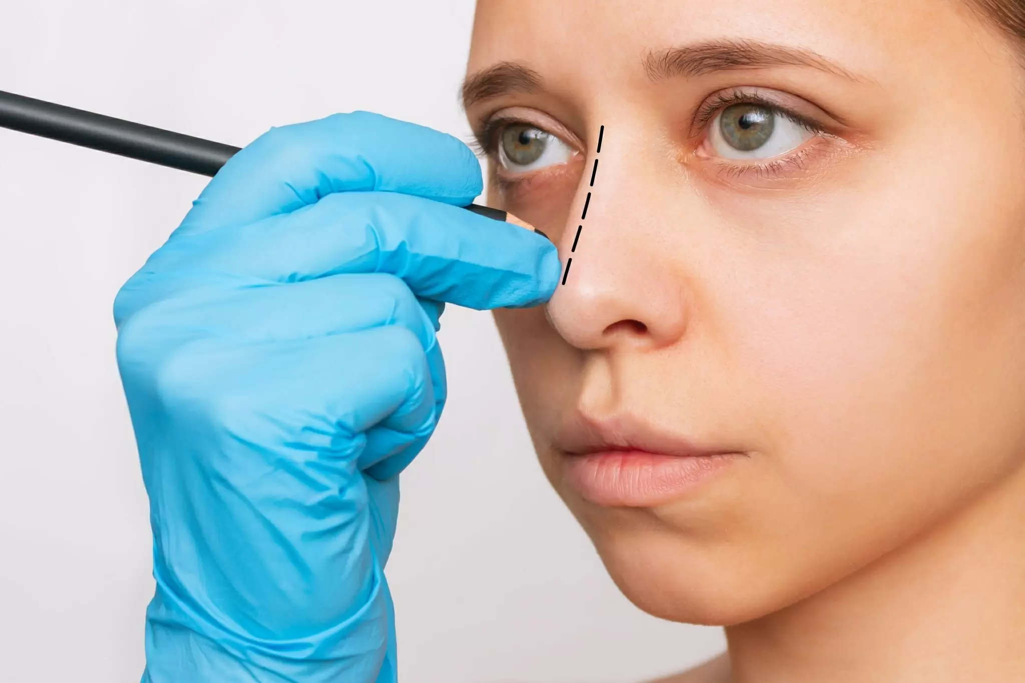 how much does a nose job cost with insurance?