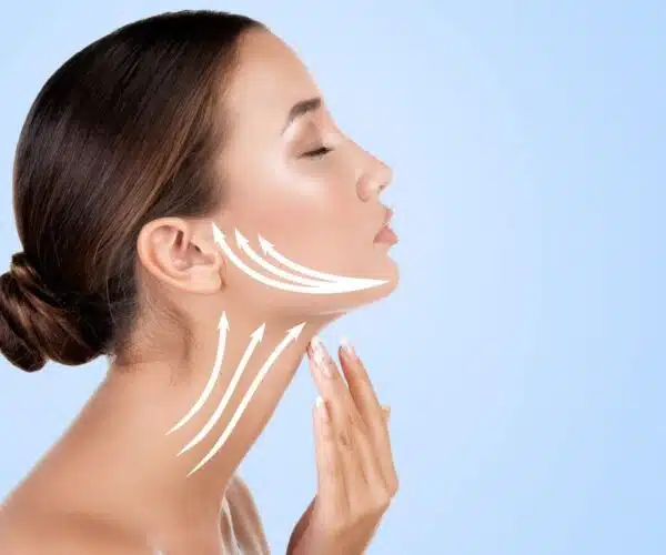 neck lift recovery time