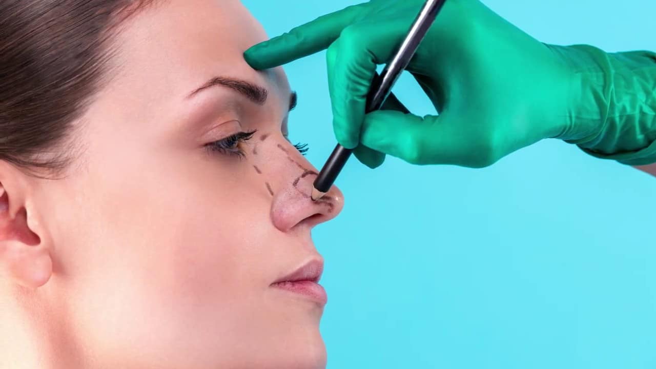 septorhinoplasty cost