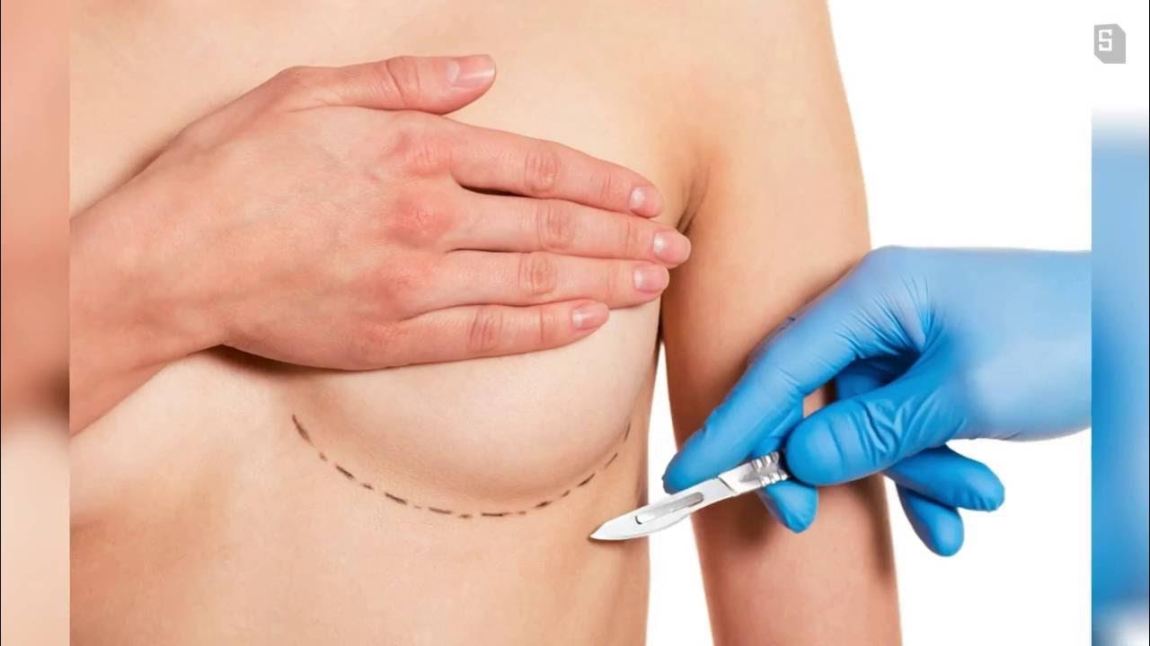 why do women get breast implants?