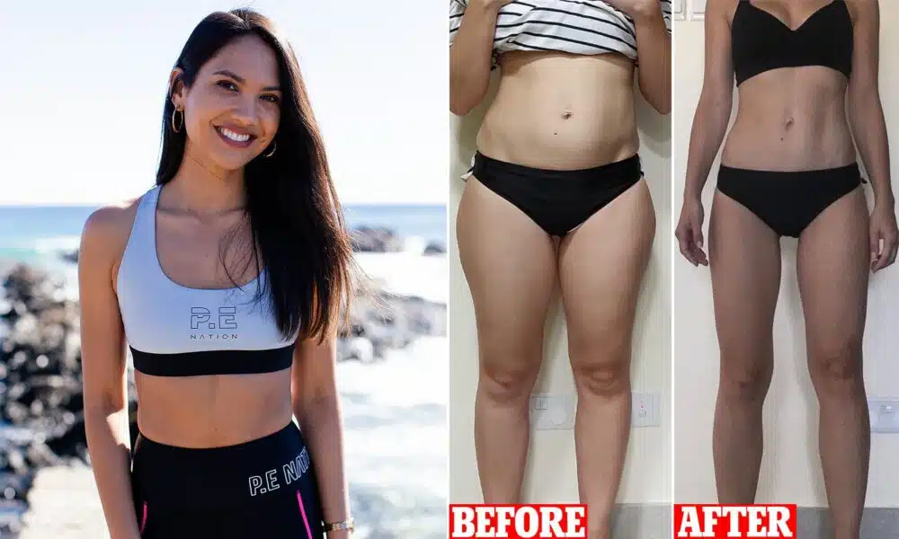 Fat Transfer for Skinny Legs Cost