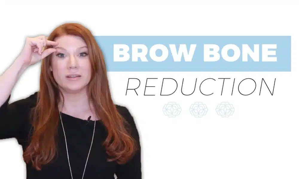 brow bone reduction