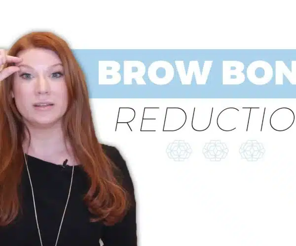 brow bone reduction