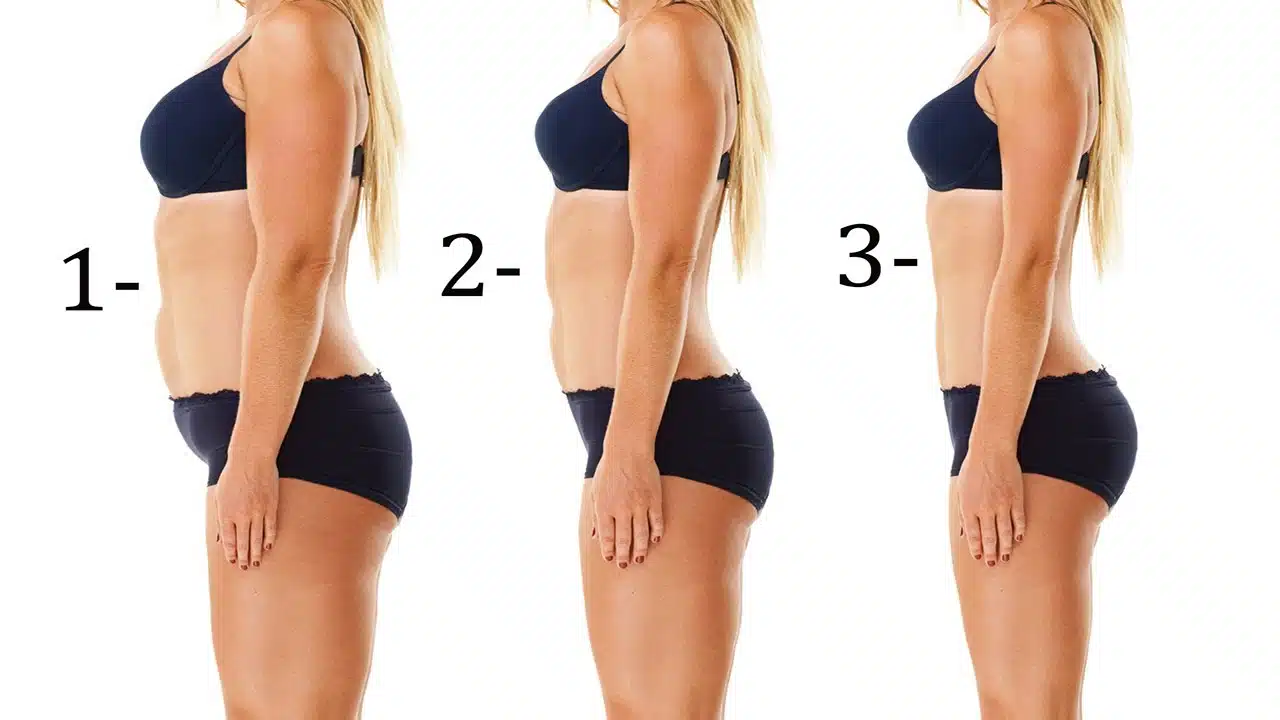 fat transfer for skinny legs cost