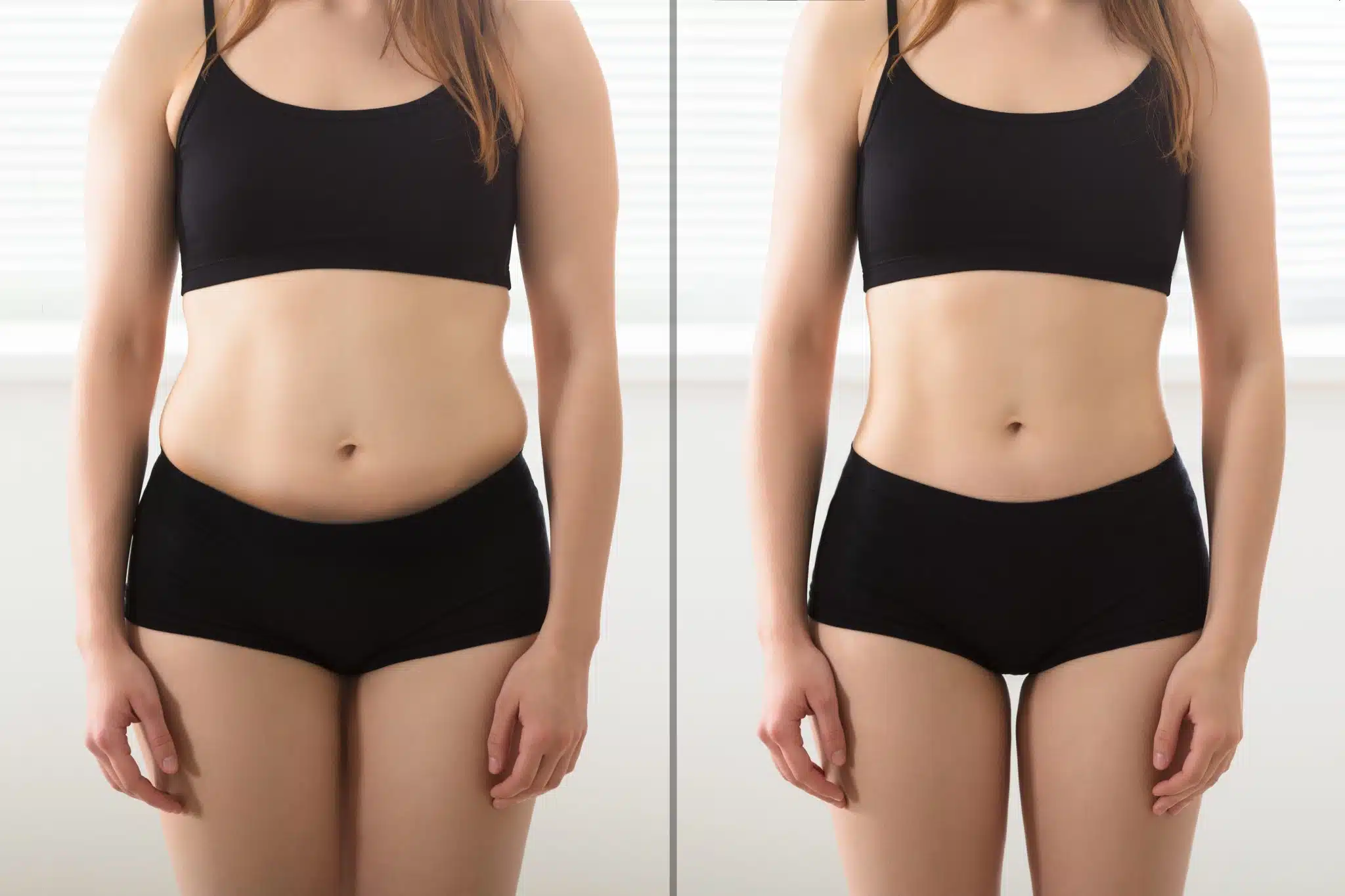 fat transfer for skinny legs cost