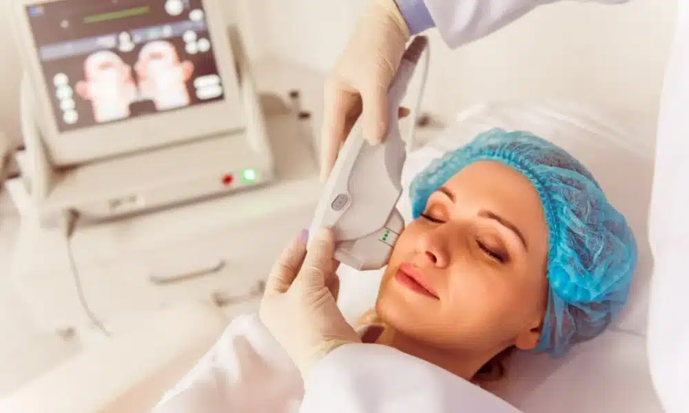 hifu therapy for face