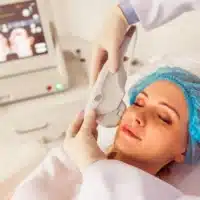 hifu therapy for face