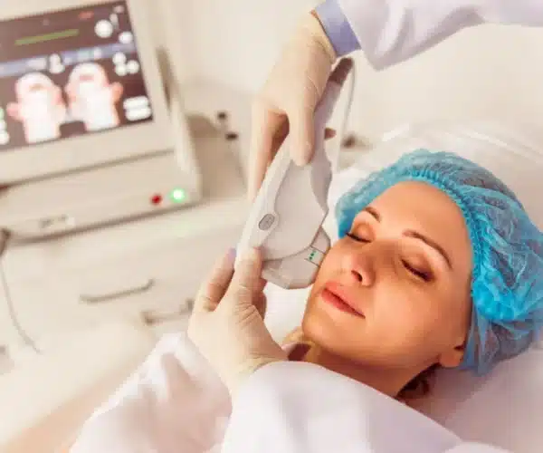 hifu therapy for face
