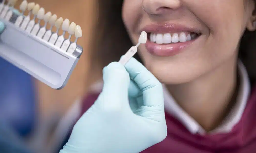 how much do veneers cost in turkey