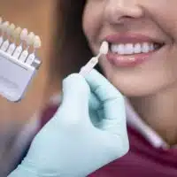 how much do veneers cost in turkey