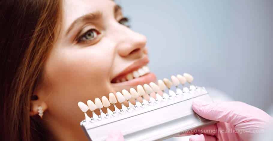 how much do veneers cost in turkey