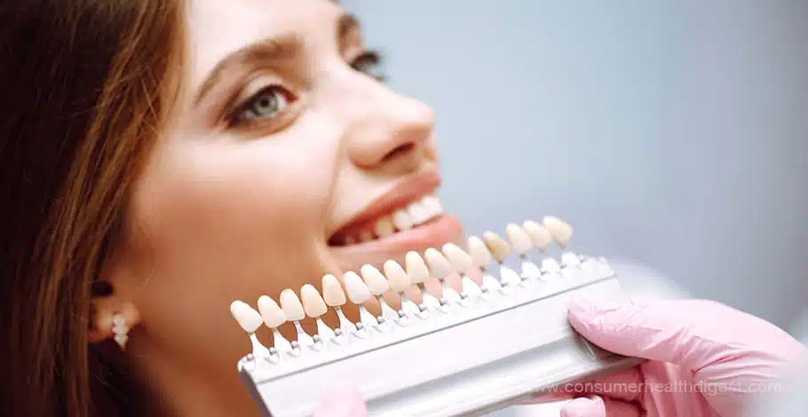how much do veneers cost in turkey