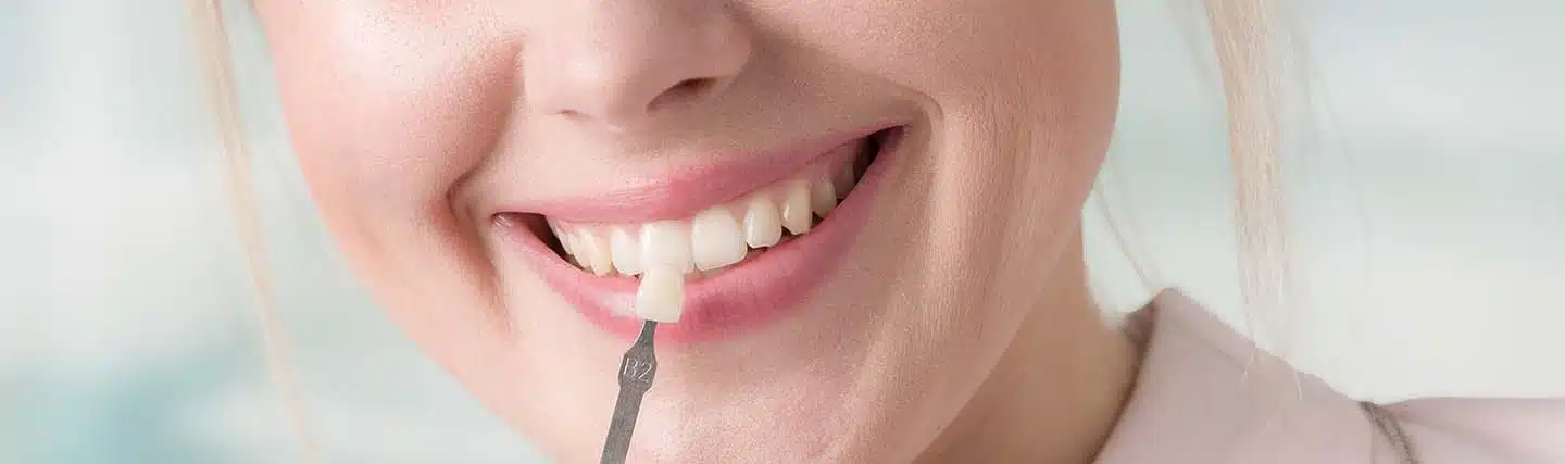 how much do veneers cost in turkey