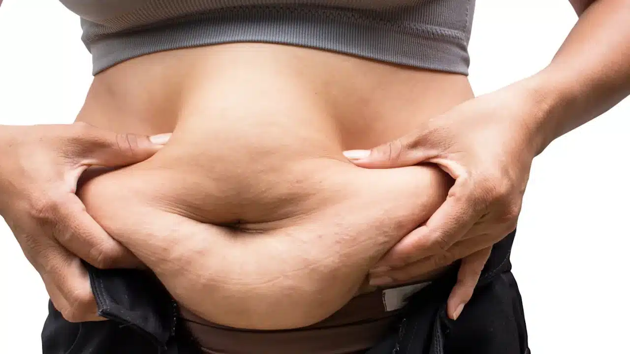 how much is a fat transfer from stomach to buttocks