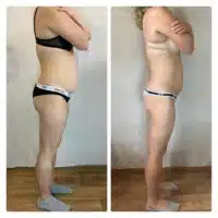 how much is a fat transfer from stomach to buttocks