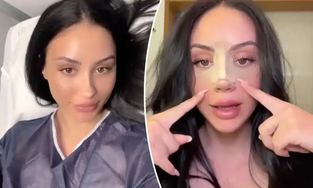 nose surgery turkey cost