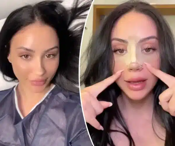 nose surgery turkey cost