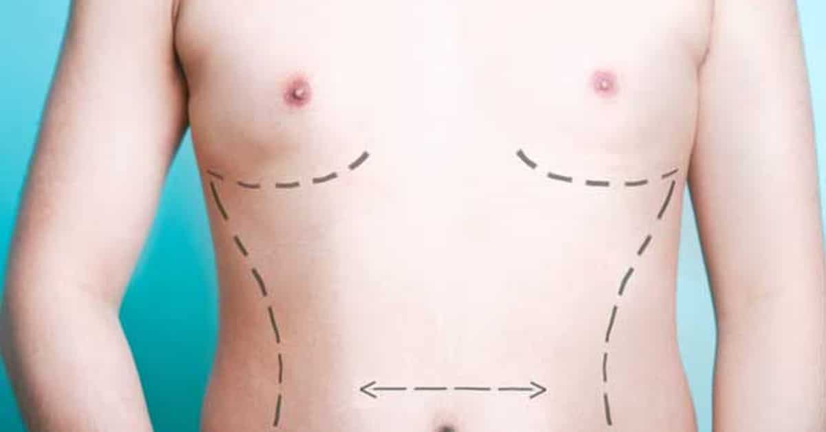 permanent male enlargement surgery cost