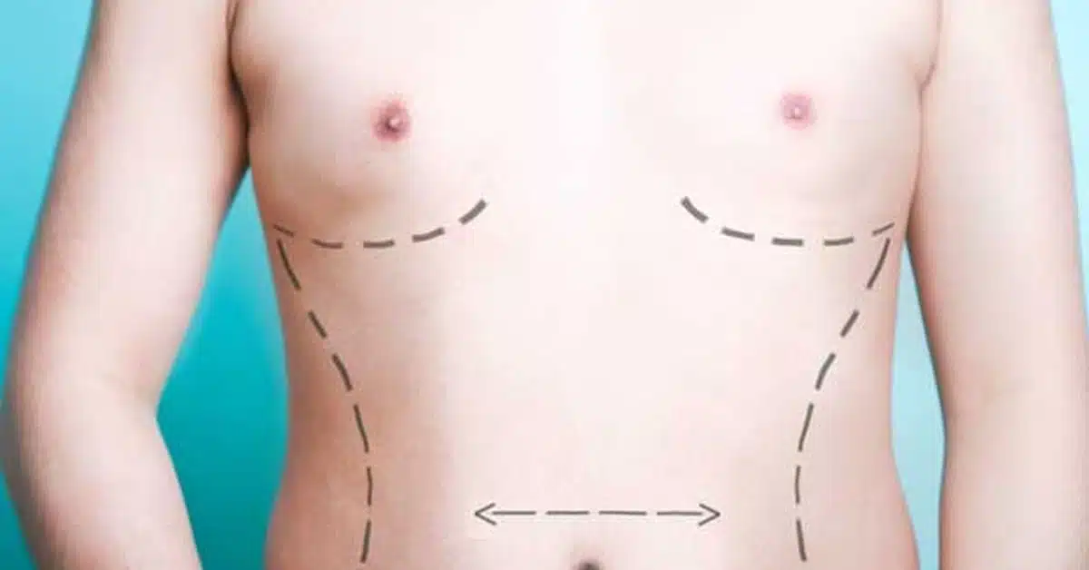 permanent male enlargement surgery cost