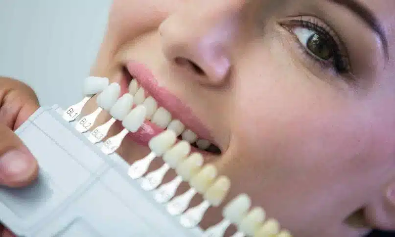 veneers in turkey price